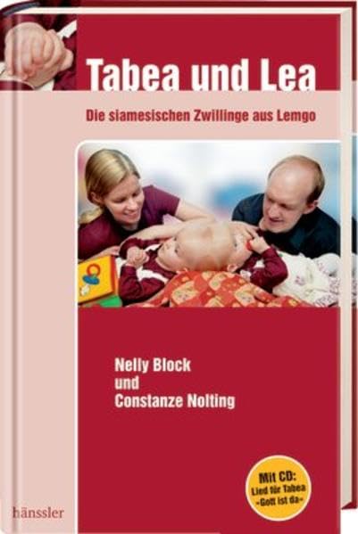 Tabea und Lea - die siamesischen Zwillinge aus Lemgo