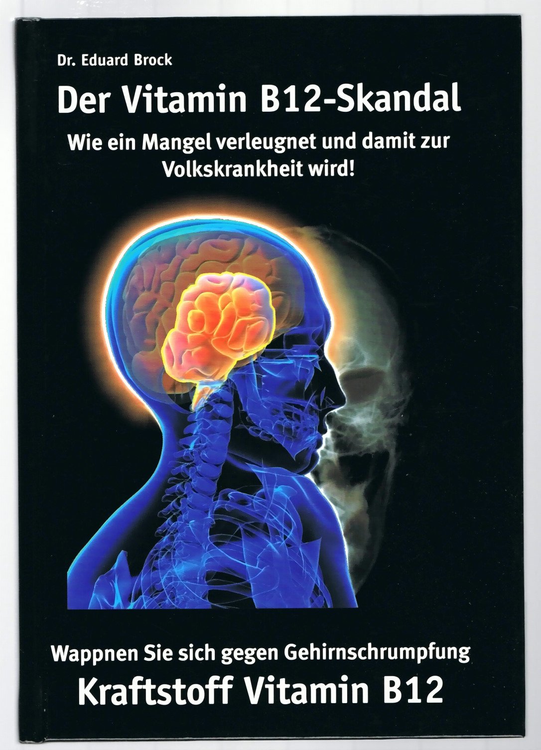 Der Vitamin B12 - Skandal. Wie ein Mangel verleugnet und damit zur Volkskrankheit wird