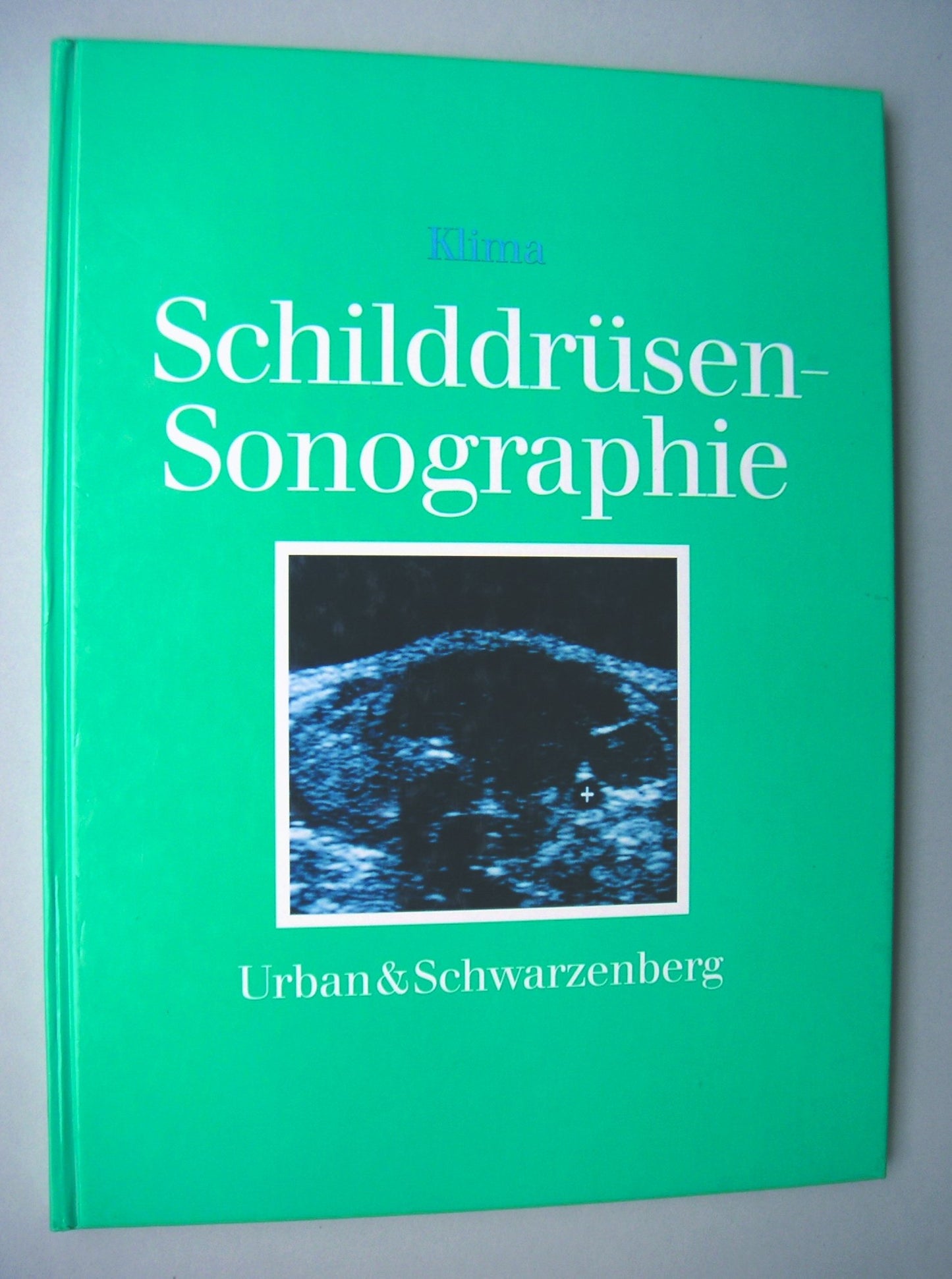 Schilddrüsen-Sonographie