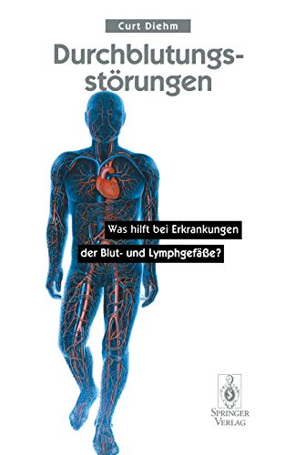 Durchblutungsstörungen: Was Hilft Bei Erkrankungen Der Blutund Lymphgefäße?